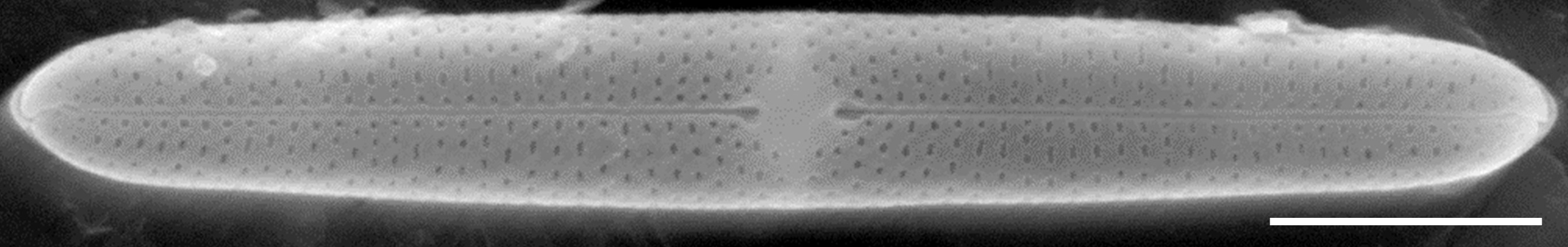 Tursiocola bondei SEM5