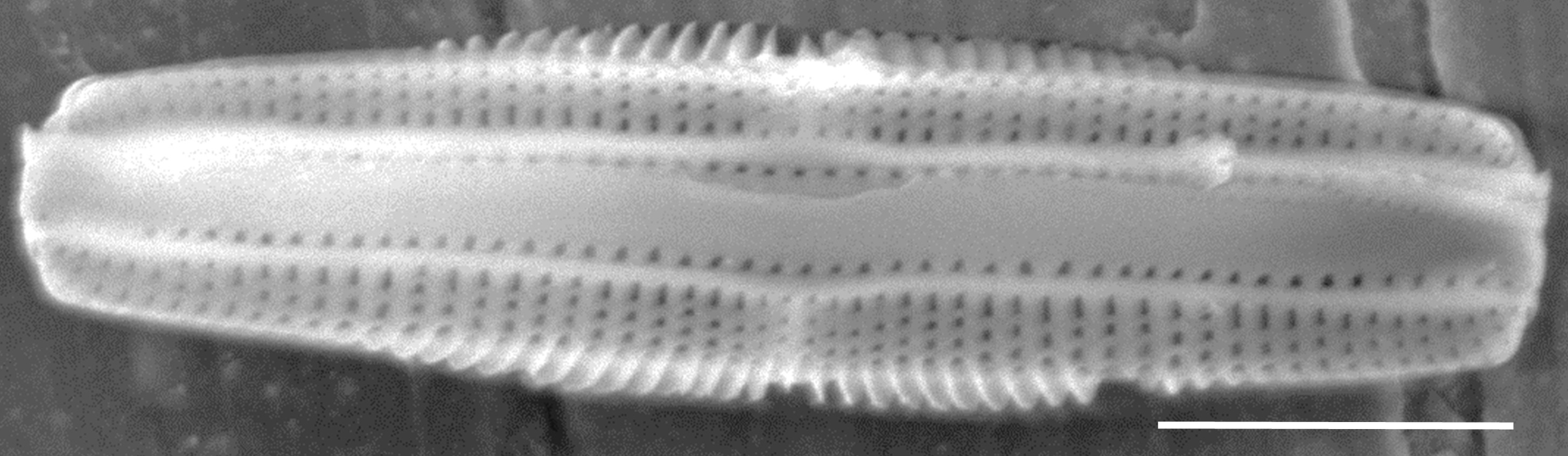 Tursiocola costata SEM1