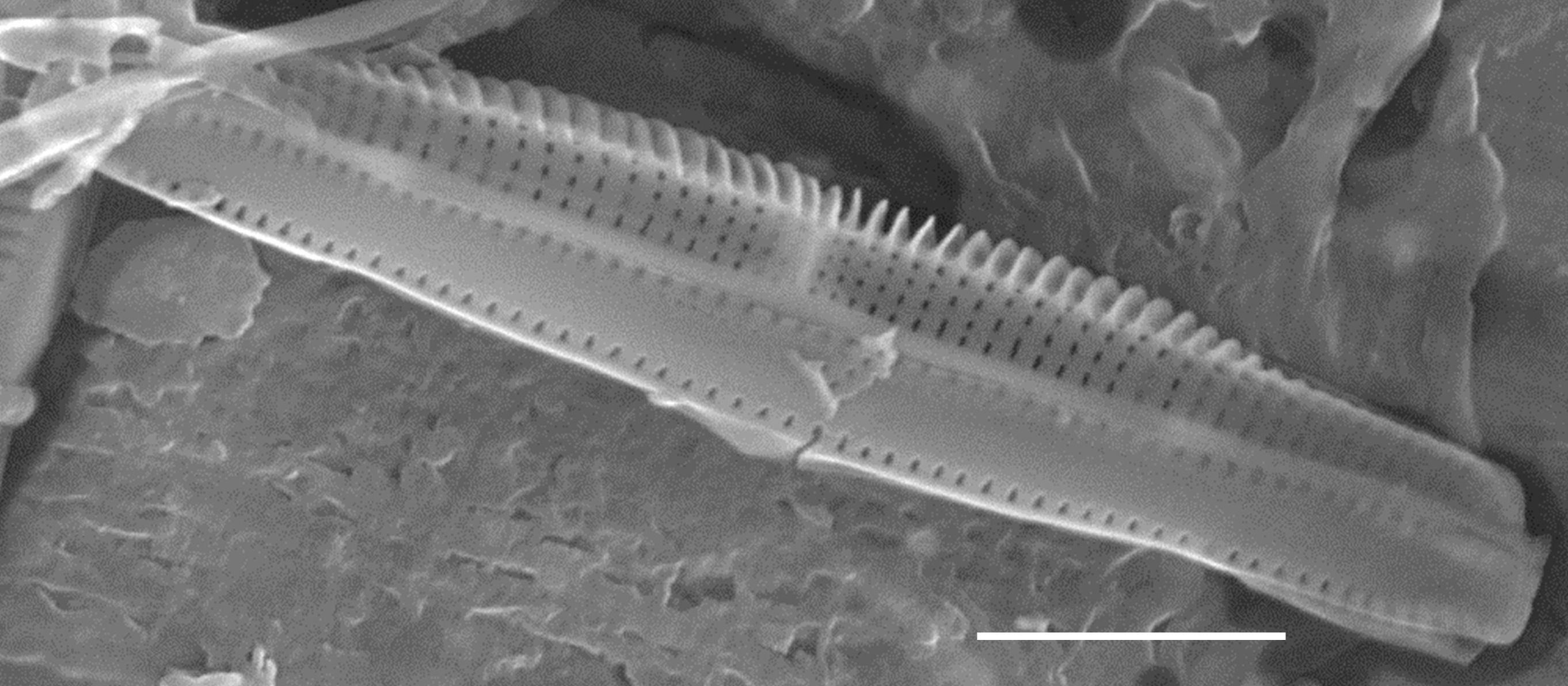 Tursiocola costata SEM2