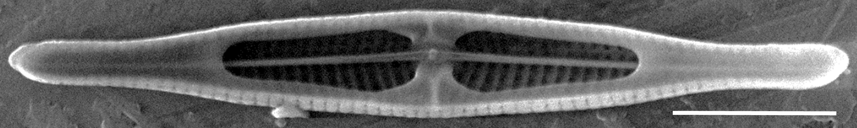 Tursiocola costata SEM4