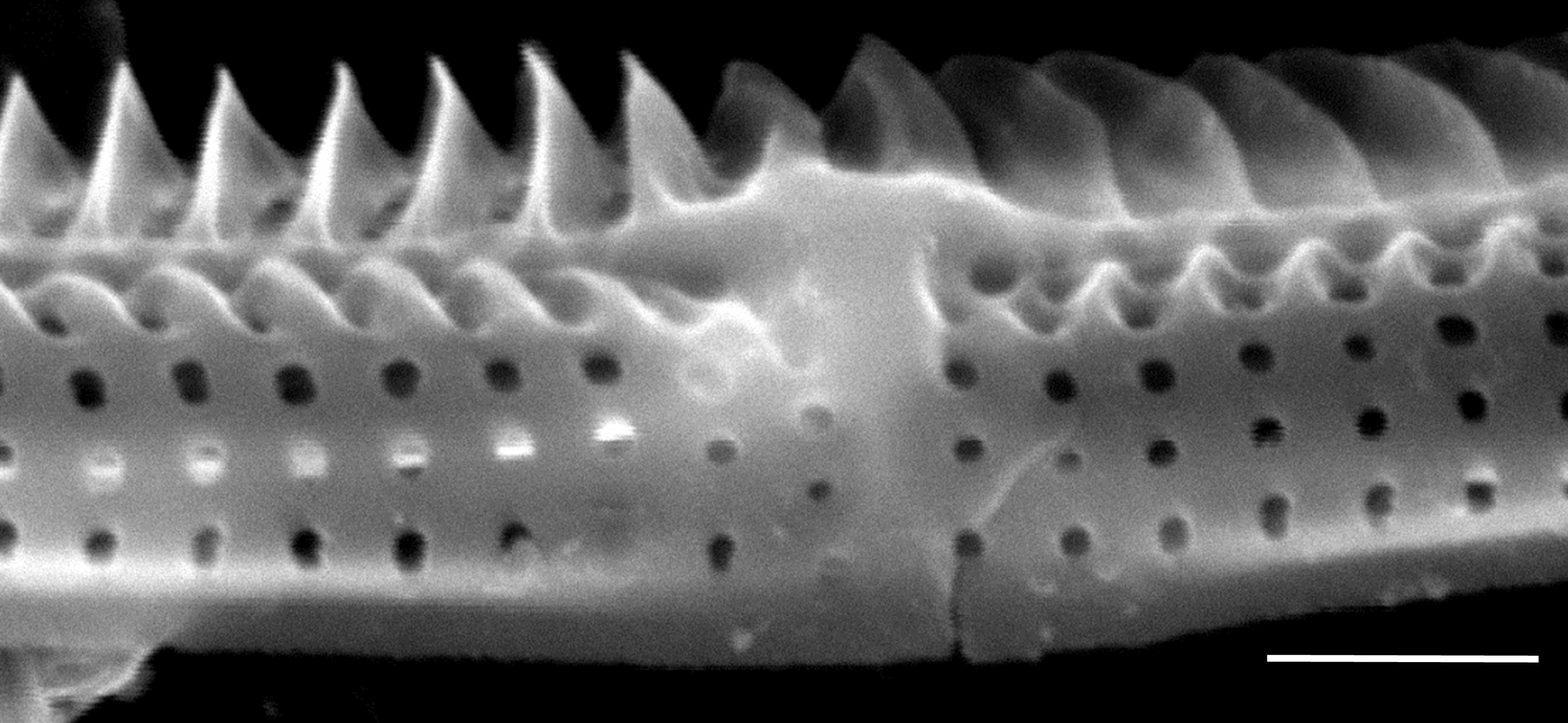Tursiocola costata SEM5