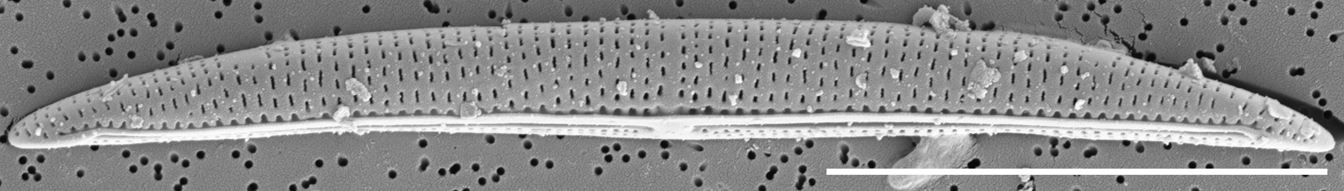 Tursiocola cymbelloides SEM1