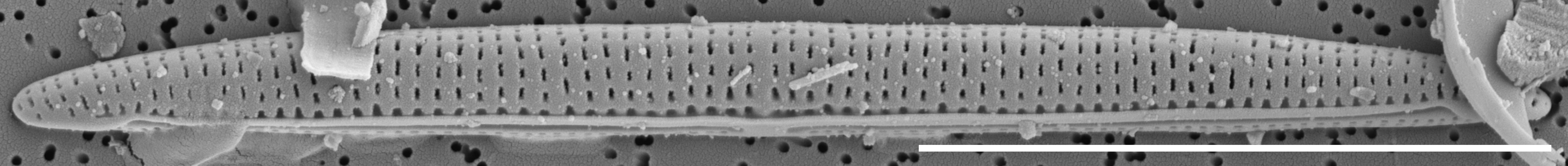 Tursiocola cymbelloides SEM2