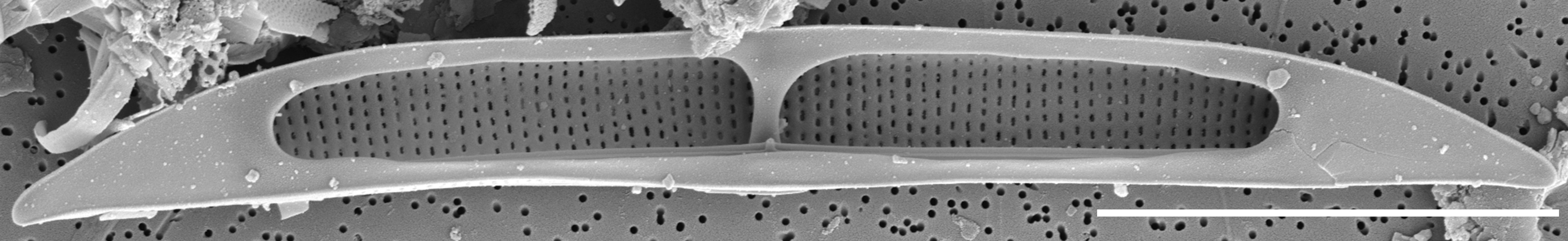 Tursiocola cymbelloides SEM3