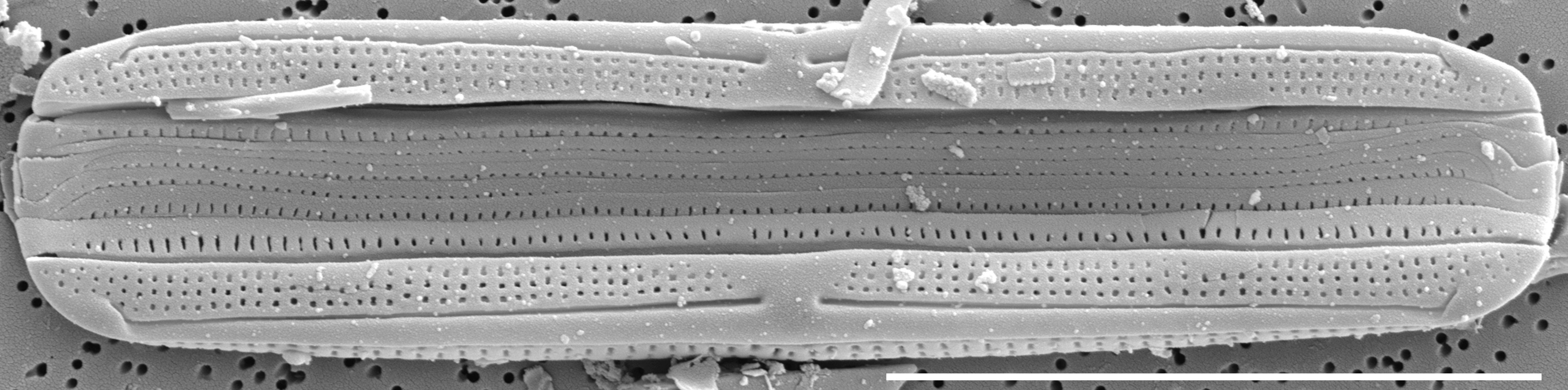 Tursiocola cymbelloides SEM4