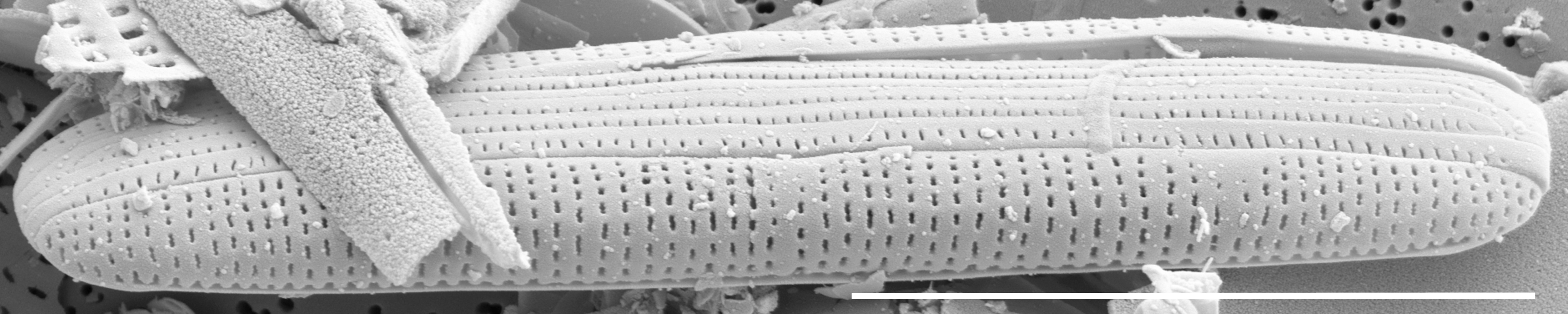 Tursiocola cymbelloides SEM5