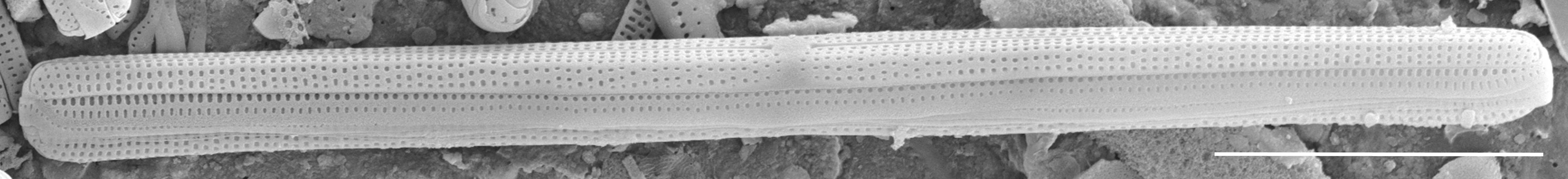 Tursiocola gracilis SEM1