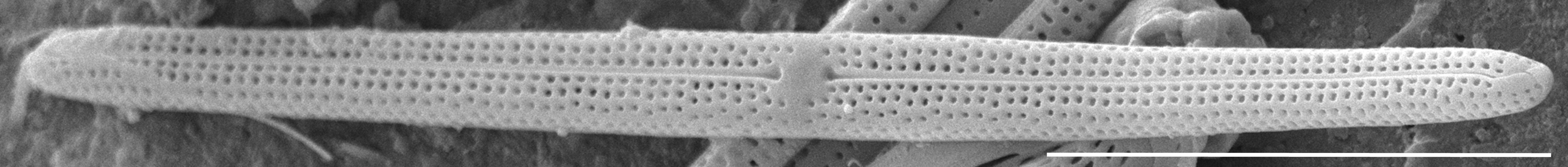 Tursiocola gracilis SEM2