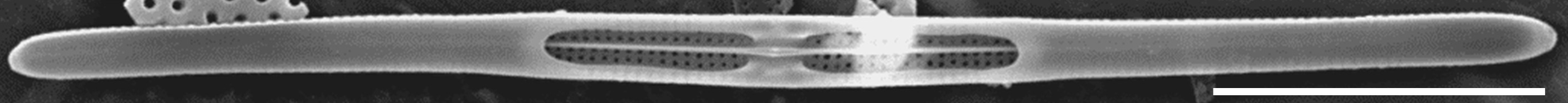Tursiocola gracilis SEM3