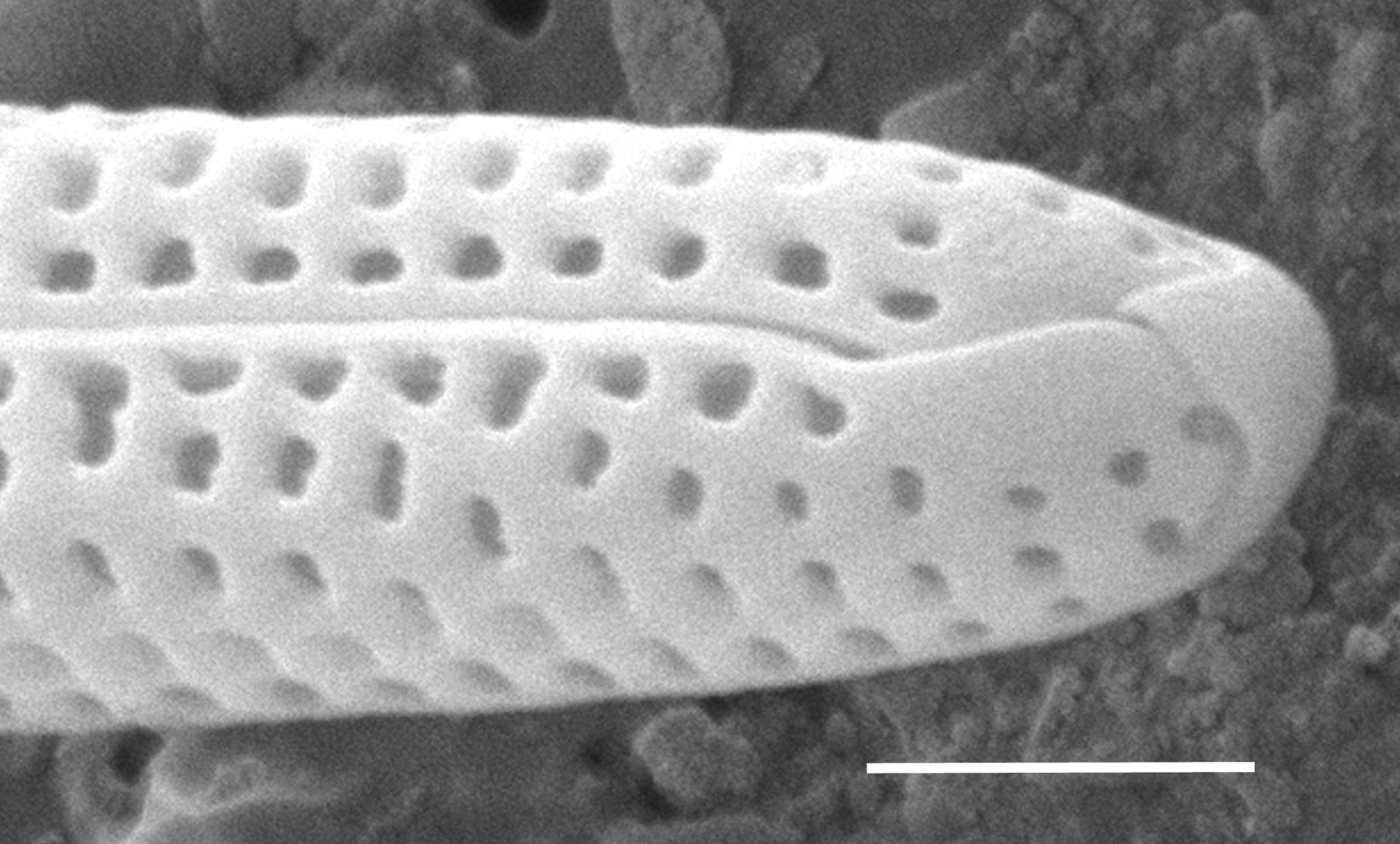 Tursiocola gracilis SEM4