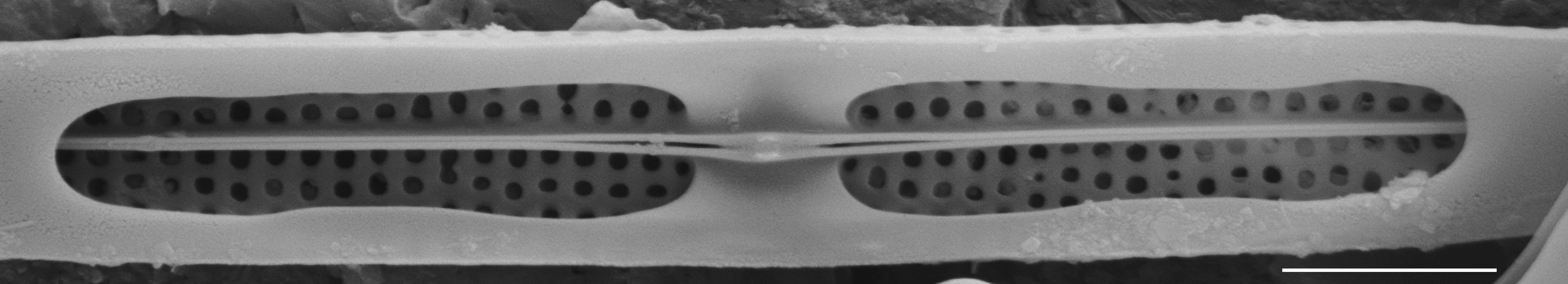 Tursiocola gracilis SEM5