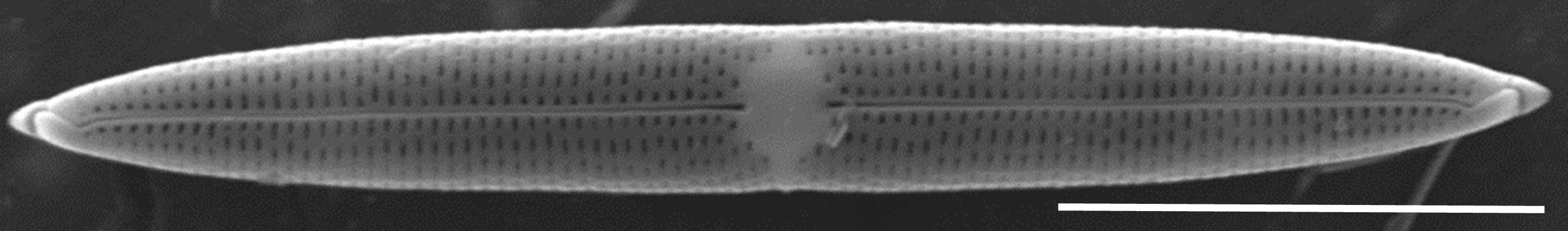 Tursiocola varicopulifera SEM1