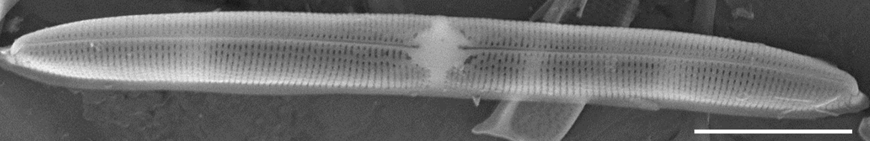 Tursiocola varicopulifera SEM2