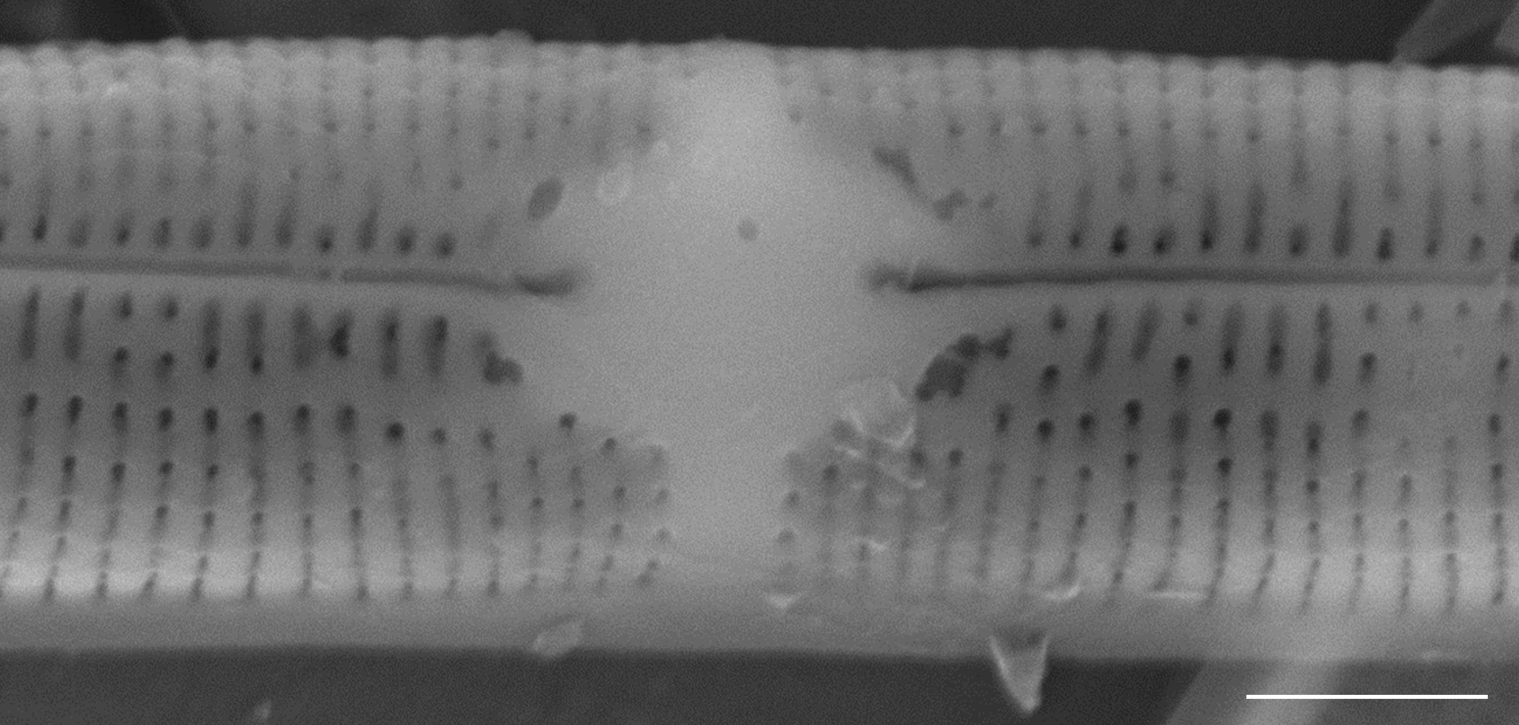 Tursiocola varicopulifera SEM3