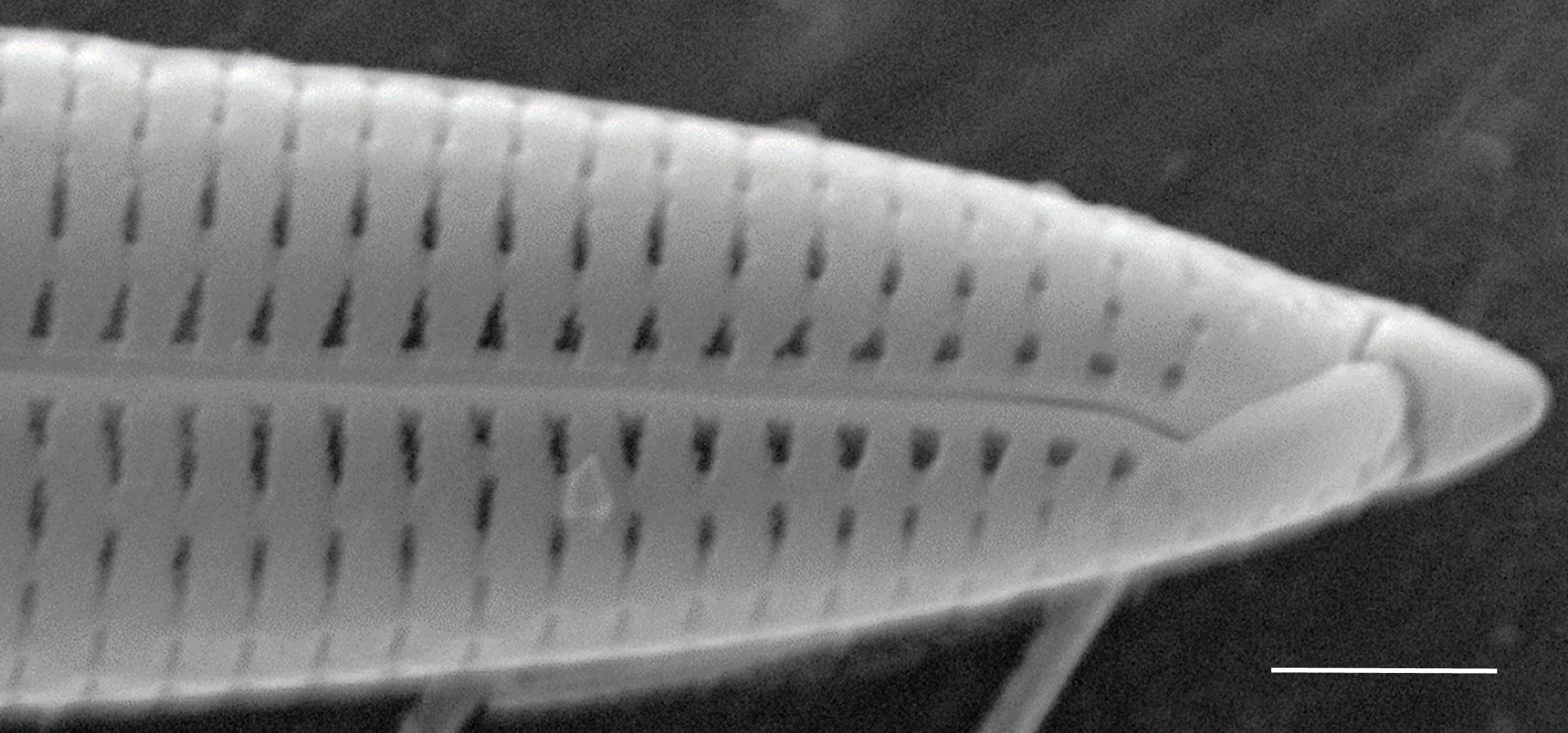 Tursiocola varicopulifera SEM4