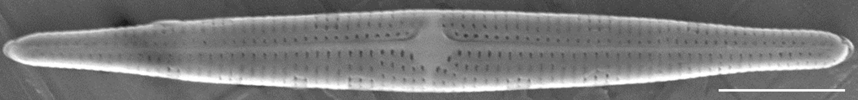 Tursiocola ziemanii SEM1