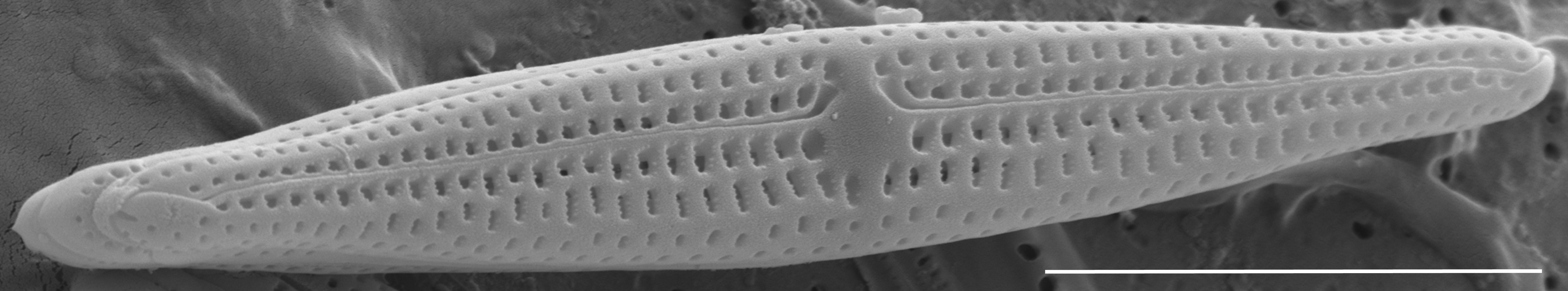 Tursiocola ziemanii SEM3