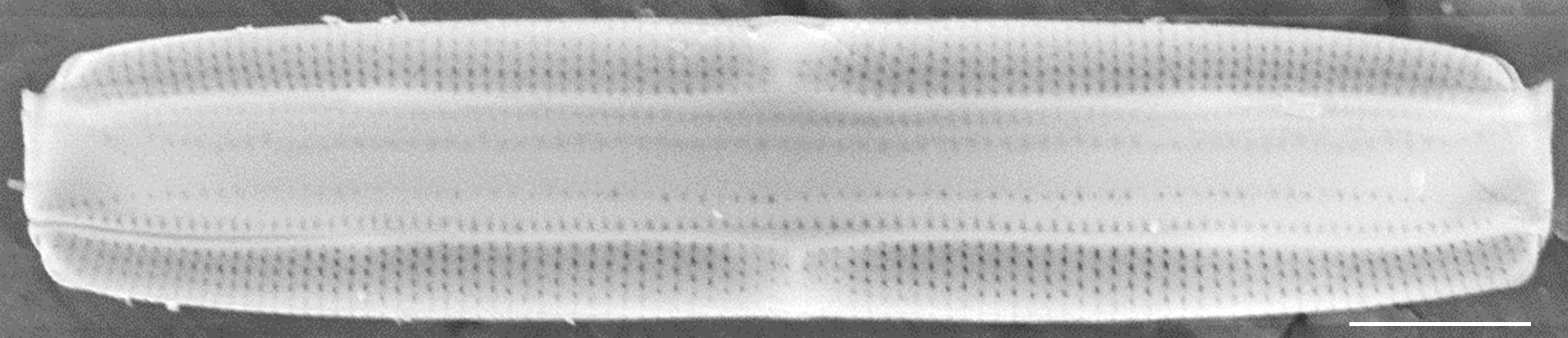 Tursiocola ziemanii SEM4