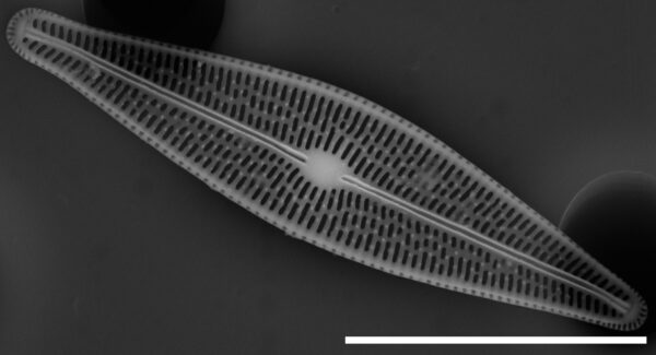 Brachysira chiaruccii SEM10 INSTAAR 17660