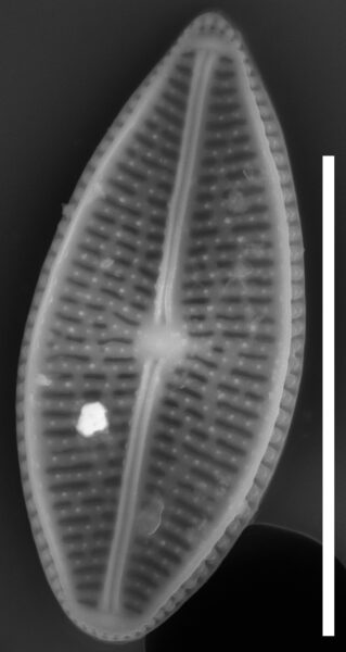 Brachysira chiaruccii SEM13 INSTAAR 17660