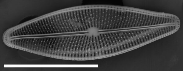 Brachysira chiaruccii SEM1 INSTAAR 17660