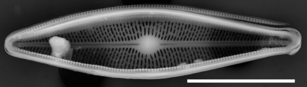 Brachysira chiaruccii SEM5 INSTAAR 17660