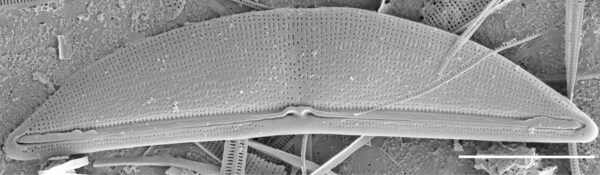Halamphora baleenicola SEM1