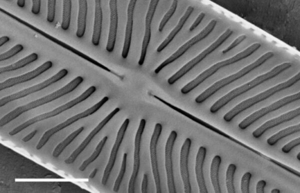 Kobaysiella tursujuqensis SEM2