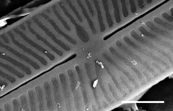 Kobaysiella tursujuqensis SEM3