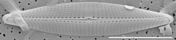 Proschkinia vergostriata SEM1