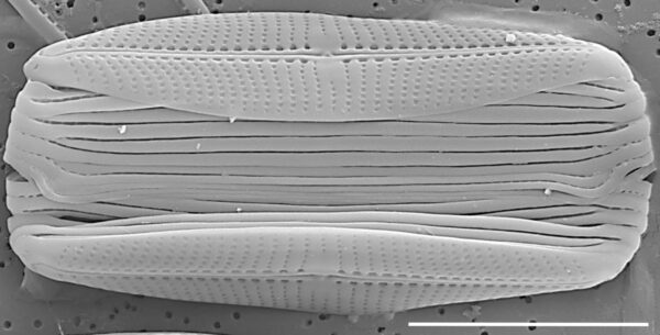 Proschkinia vergostriata SEM2