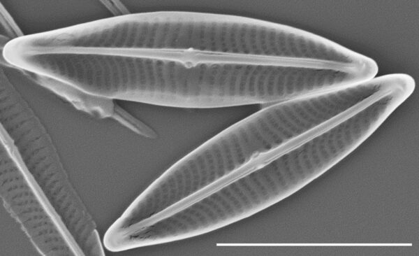 Proschkinia vergostriata SEM3