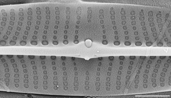 Proschkinia vergostriata SEM5