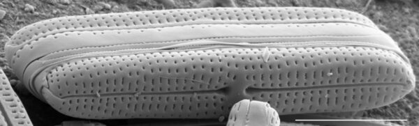 Tursiocola bondei SEM1