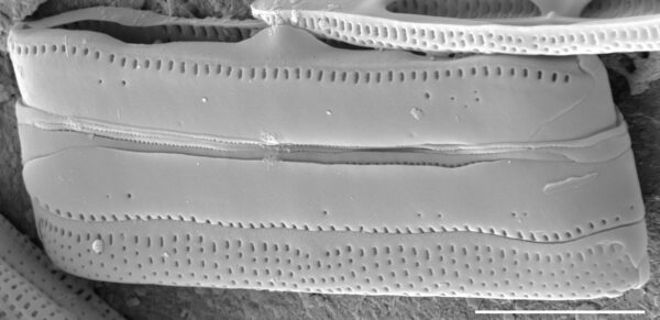 Tursiocola bondei SEM2