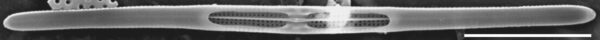 Tursiocola gracilis SEM3