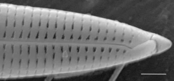 Tursiocola varicopulifera SEM4