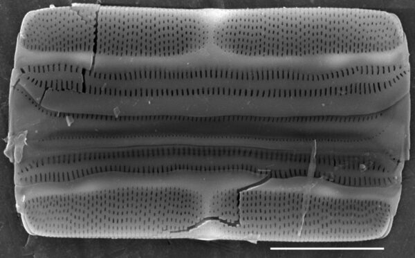 Tursiocola varicopulifera SEM5