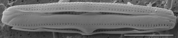 Tursiocola ziemanii SEM5