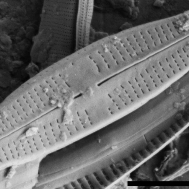 Achnanthidium thienemannii SEM2