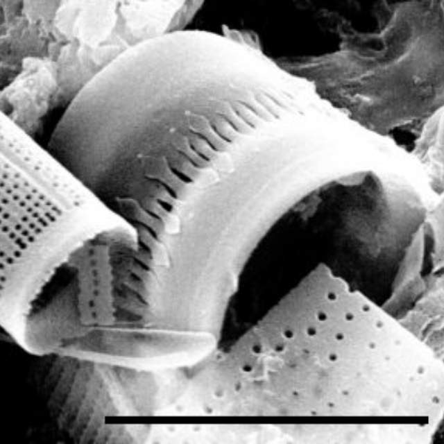 Aulacoseira pseudoamericana SEM