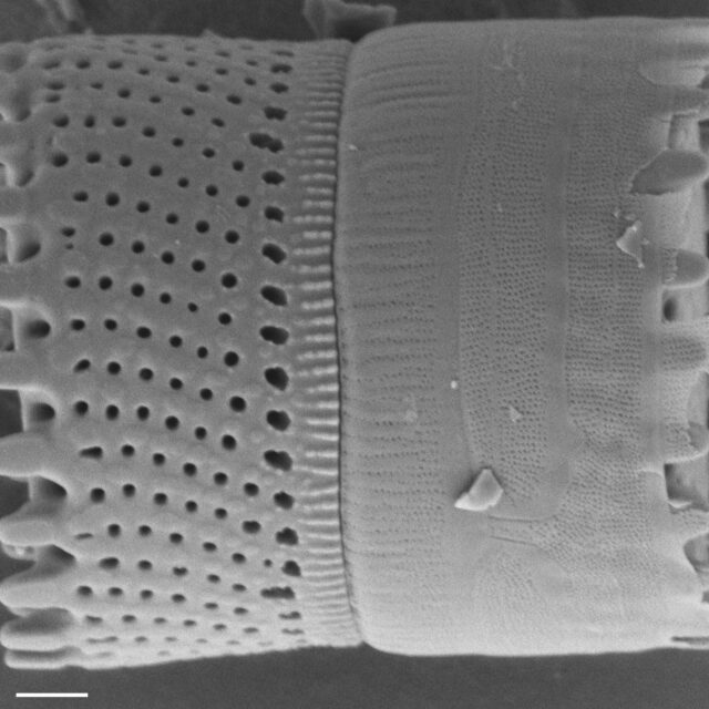Aulacoseira scalaris SEM1