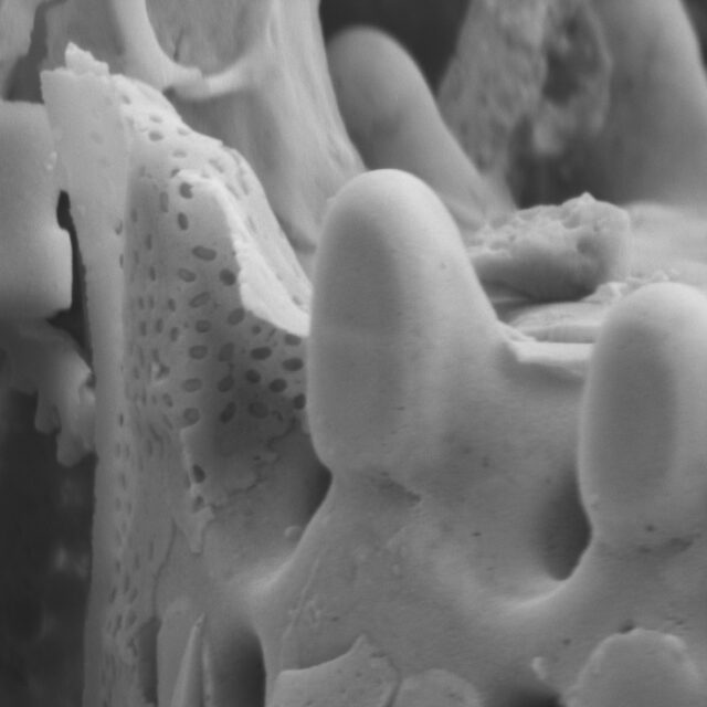 Aulacoseira scalaris SEM3