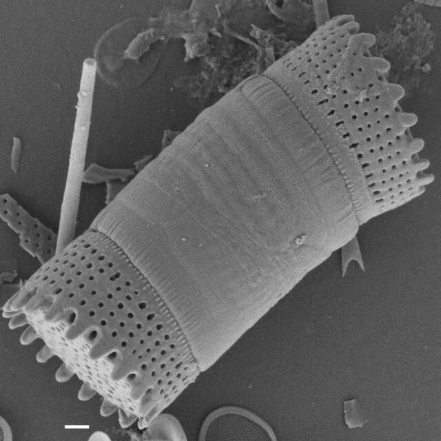 Aulacoseira scalaris SEM5