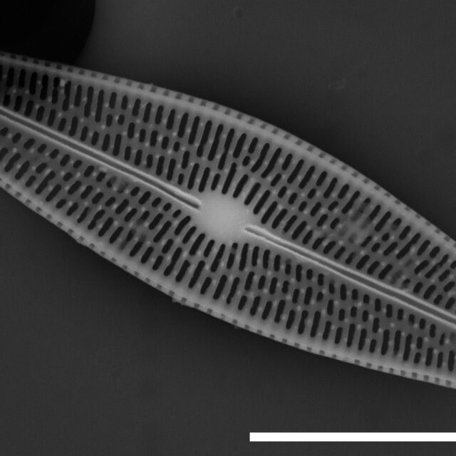 Brachysira chiaruccii SEM10 INSTAAR 17660