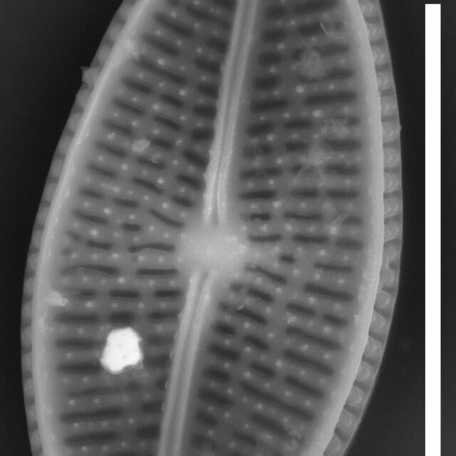 Brachysira chiaruccii SEM13 INSTAAR 17660