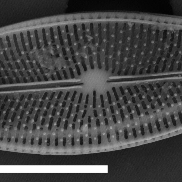 Brachysira chiaruccii SEM1 INSTAAR 17660