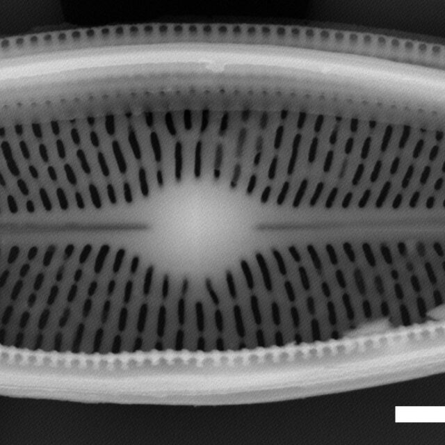 Brachysira chiaruccii SEM5 INSTAAR 17660