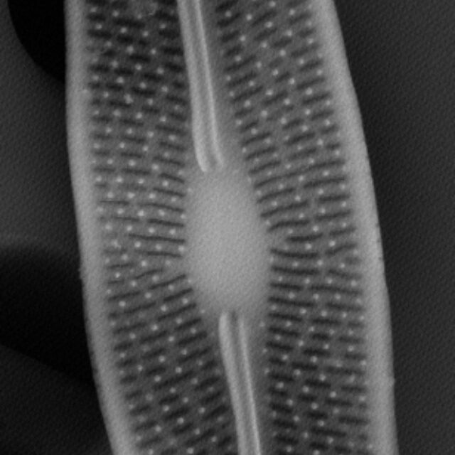 Brachysira chiaruccii SEM7 INSTAAR 17660