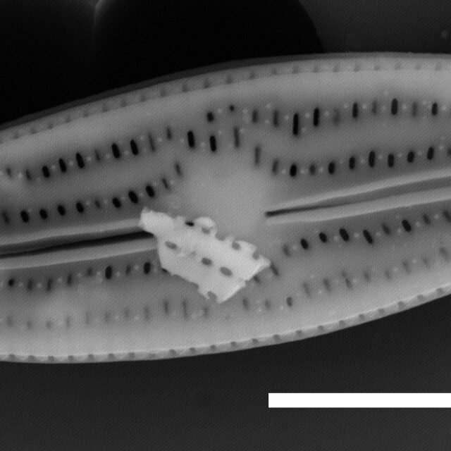 Brachysira elisabethiana INSTAAR 17660